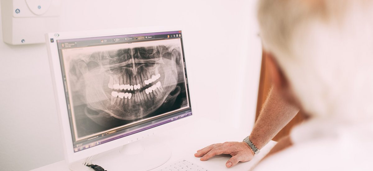 Endodontie - Röntgenbild eines Gebisses in der Zahnarztpraxis Dr. Pfitzer in Stuttgart