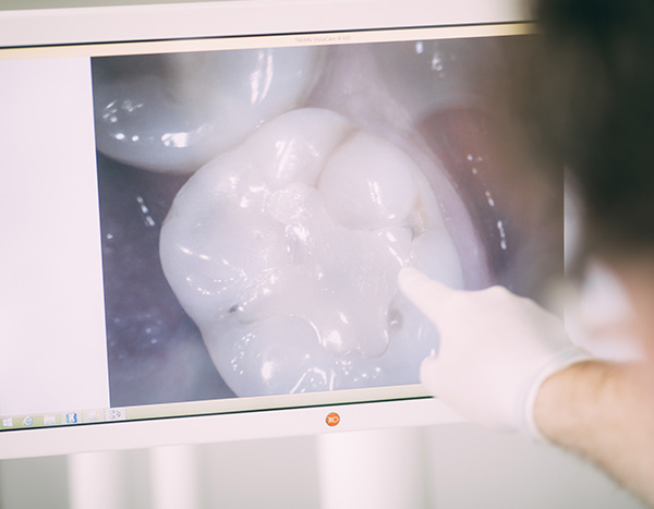 Technik - Das Bild einer intraoralen Kamera in der Zahnarztpraxis Dr. Pfitzer in Stuttgart
